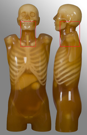 anatomical protocol - throat