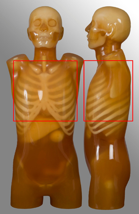 anatomical protocol - chest