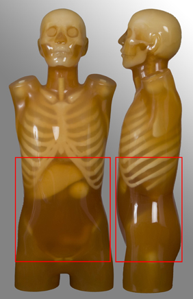 anatomical protocol - abdo/pelvis