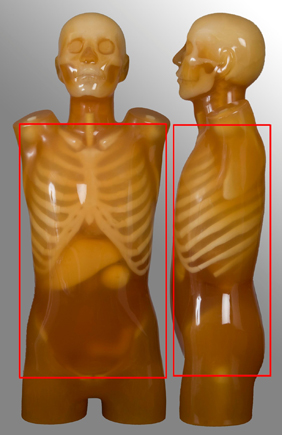 anatomical protocol - chest abdo/pelvis