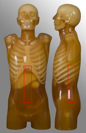 anatomical protocol - throat