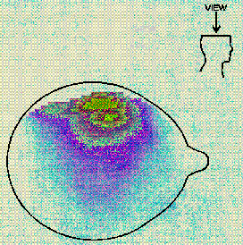 Cross section of Thermal Distribution of RF Absorption in the Head - 43695 Bytes