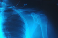 X ray image