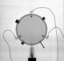 x-ray photograph