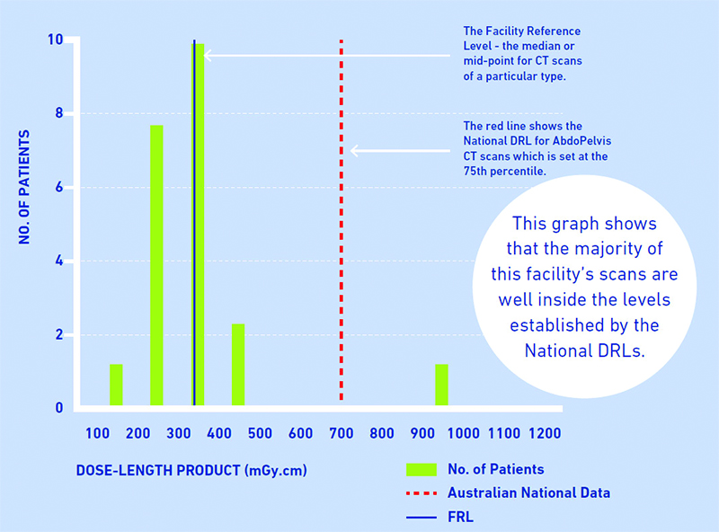 The relationship between an FRL for a particular scan and the national DRL for that scan