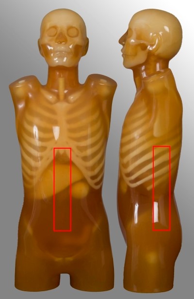 MDCT lumbar spine scan region