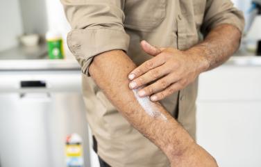 A man applies sunscreen to his arm.