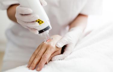 A clinician is applying a radiation treatment to someone's hand