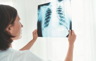 A doctor examines a chest X-ray against a lightbox