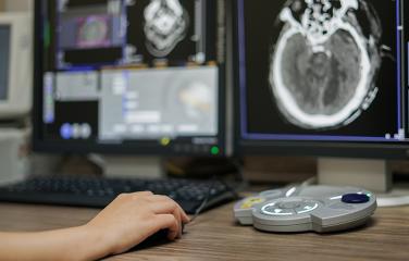 CT imaging diagnostic reference levels