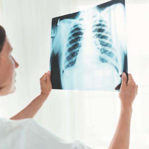 A medical person is looking at a chest x-ray