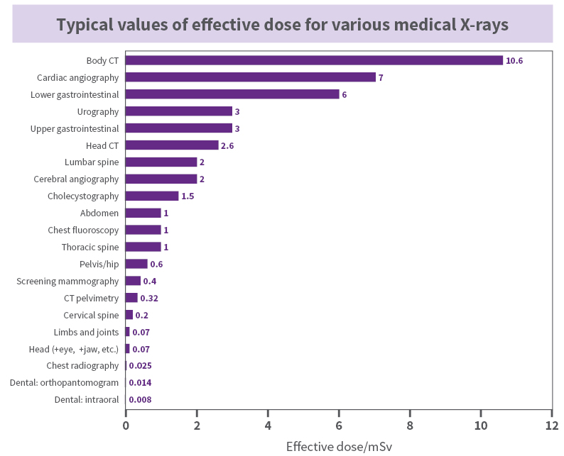 X Ray Radiation Exposure Chart